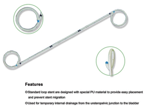 URETERAL STENT SET